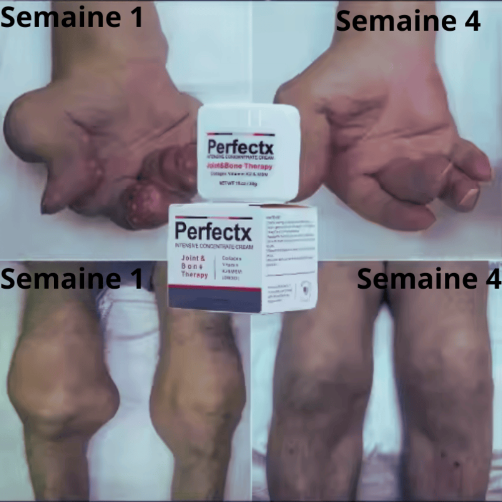 KIT RENAISSANCE ARTICULAIRE Ne survivez plus avec la douleur. Recommencez à vivre.